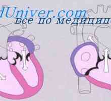 Anomalii ale vezicii urinare a embrionului. Defecte in vezica urinara a fatului