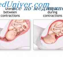 Mușchii abdominali în timpul nașterii. activitatea uterină