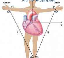 Vectorcardiogram. Axa electrică a inimii