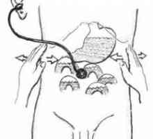 Chirurgie direct asupra tractului biliar cu icter obstructiv