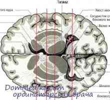 Neurotransmițătorii sunt ganglionii bazali. boala lui Parkinson