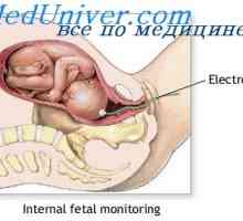 Detașamentul și nașterea placentei. Durere in timpul nasterii