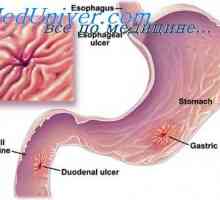 Digestia grăsimilor. Etapele digestiei grăsimilor din intestin
