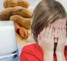 Alergii alimentare la copii mai mari de 7 ani