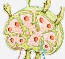 Cancerul a ganglionilor limfatici si stomac: diagnostic și tratament