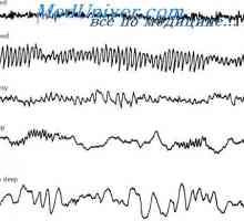 Undele cerebrale si nivelurile de activitate a creierului. O electroencefalogramă (EEG) somn