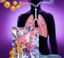 Silicoza, tratamentul pulmonar
