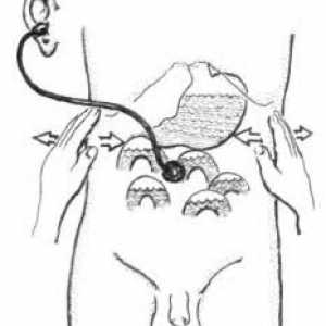 Ureter spirală și ureterocelului