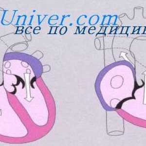 Anomalii ale vezicii urinare a embrionului. Defecte in vezica urinara a fatului
