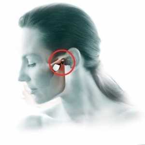 Artrita articulatiei temporomandibulare: tratament, simptome, diagnostic