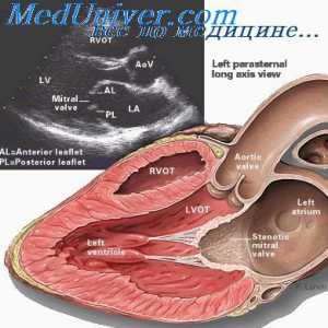 Tulburări hemodinamice în defecte cardiace, și efort fizic