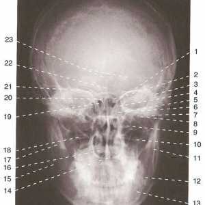Craniu cu raze X anatomie