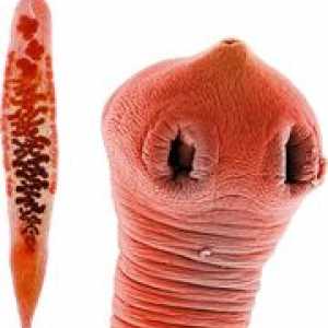 Simptome viermi (helminți) și conducte biliare