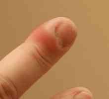 Abcesul degetul
