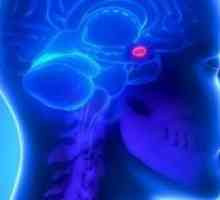 Adenom glanda pituitara a creierului: a simptomelor, tratarea și eliminarea, prognoza, efectele,…