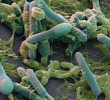 Bacteriile anaerobe: tipuri