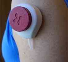 Testul de sânge fără durere de vacuum
