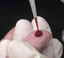 Analiza oxiurilor sanguine (enterobiazei)