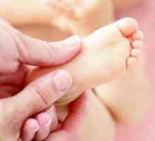 Anomaliile solduri, picioare, picioare, gât, spate, anomalii musculare la copii