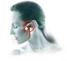 Artrita articulatiei temporomandibulare: tratament, simptome, diagnostic