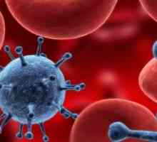 Autoimuna Anemia hemolitica: Tratamentul, cauze, simptome, diagnostic