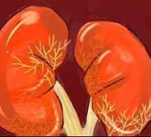 Autosomal boala rinichiului polichistic dominanta