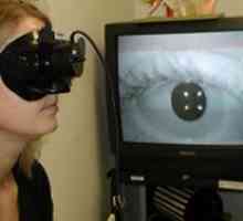 Coordonarea mișcărilor oculare binoculară
