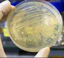 Analiza biochimică a suprainfectia bacterii fecale