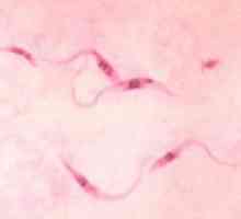 Boala Chagas: simptome, tratament, cauze, diagnostic, cauze