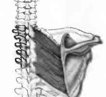 Dureri de spate cauzate de mușchii romboidale