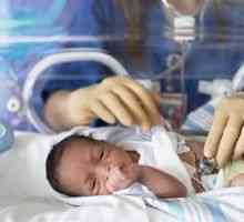 Displazia bronhopulmonară la sugari prematuri: implicatii de tratament