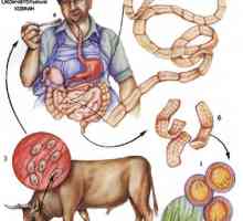 Bovine (neinarmata) teniei de carne de vită infecție teniei la om