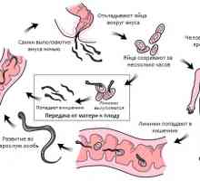 Infecție frecventă (vierme infestare) oxiurilor (enterobiazei) om