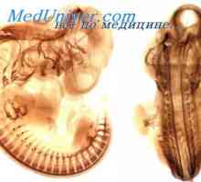 Nervi cranieni fetale. Dezvoltarea cranial nervilor Embrionul