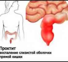 Ce este proctita intestinului?