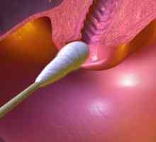 Examenul citologic al frotiului de col uterin