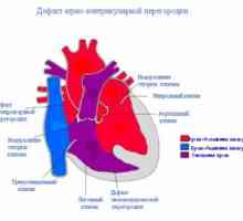 Defect septal ventricular al inimii: cauzele, tratamentul, simptome, semne