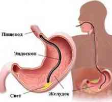 Diagnosticul gastroduodenita