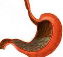 Distală esofagita de reflux non-erozivă: ce este?