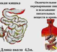 Diverticuloză simptome intestinale