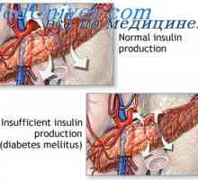 Efectul insulinei asupra metabolismului carbohidratilor. Schimbul de glucoză de către insulină