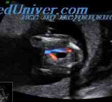 Precizia inimii fetale Doppler. performanță Doppleroehograficheskie cardiace fetale