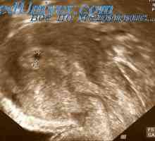 Alterarea funcțională sub efectul ultrasunetelor. anomalie fetale sub Uzi