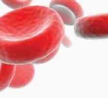 Hemoglobina (hemoglobinopatii)