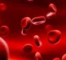 Anemia hemolitică, tratament, simptome