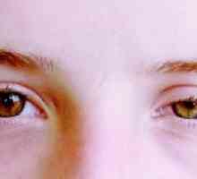 Sindrom ischemic Ocular: simptome, tratament, clasificare, cauze
