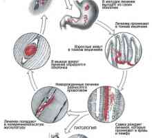 Viermii intestinali (viermi), care trăiesc în mușchi umane, simptome și fotografii