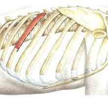Abordări chirurgicale la nivelul coloanei vertebrale toracice