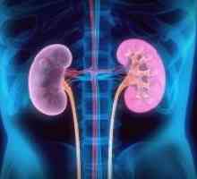 Boala cronică de rinichi: stadiu, clasificare, cauze, simptome, diagnostic, tratament, simptome