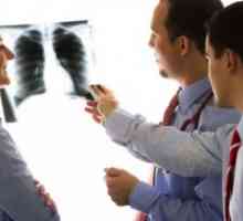 Pneumonie interstițială cronică și fibroza pulmonara, tratament, simptome, cauze